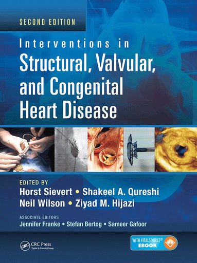 Horst Sievert, Shakeel A. Qureshi, Neil Wilson, Ziyad M. Hijazi - Interventions in Structural, Valvular and Congenital Heart Disease, Inbunden