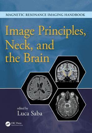Luca Saba - Image Principles, Neck, and the Brain, Inbunden