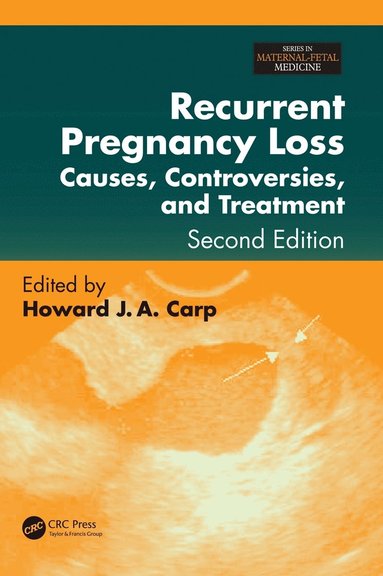 bokomslag Recurrent Pregnancy Loss