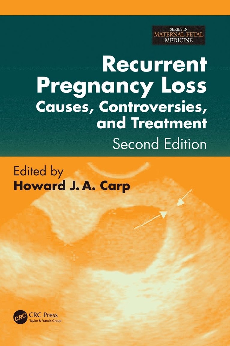 Recurrent Pregnancy Loss 1