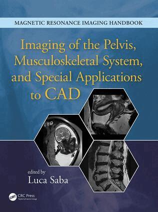 Luca Saba - Imaging of the Pelvis, Musculoskeletal System, and Special Applications to CAD, Inbunden