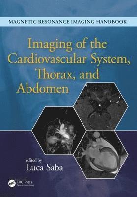 Imaging of the Cardiovascular System, Thorax, and Abdomen