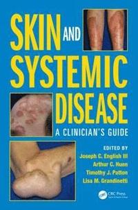 bokomslag Skin and Systemic Disease