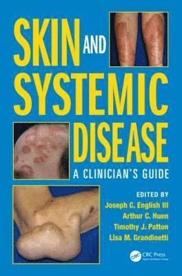 Skin and Systemic Disease 1