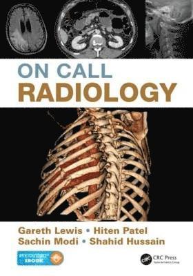 bokomslag On Call Radiology