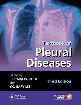 Richard W. Light, Y C Gary Lee - Textbook of Pleural Diseases, Inbunden