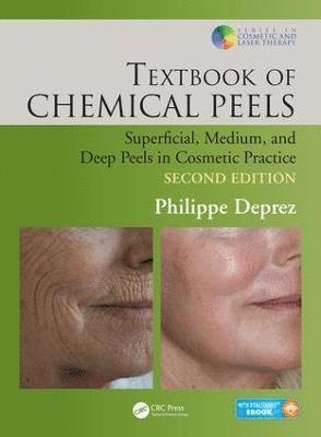 Textbook of Chemical Peels 1