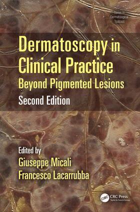 Giuseppe Micali, Francesco Lacarrubba - Dermatoscopy in Clinical Practice, Inbunden