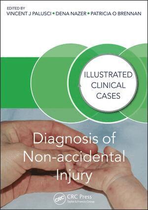 Vincent J. Palusci, Dena Nazer, Patricia Brennan - Diagnosis of Non-accidental Injury, Häftad