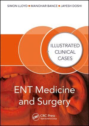Jayesh Doshi, Manohar Bance, Simon Lloyd - ENT Medicine and Surgery, Häftad