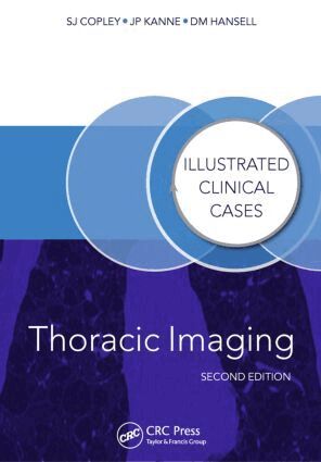 Sue Copley, David Hansell, Jeffrey Kanne - Thoracic Imaging, Häftad