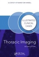 bokomslag Thoracic Imaging