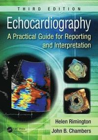 bokomslag Echocardiography