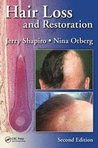 bokomslag Hair Loss and Restoration