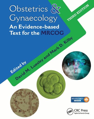Mark D. Kilby, David M. Luesley - Obstetrics & Gynaecology, Inbunden