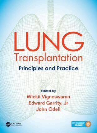Wickii Vigneswaran, Edward Garrity, John Odell - Lung Transplantation, Inbunden