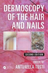 bokomslag Dermoscopy of the Hair and Nails