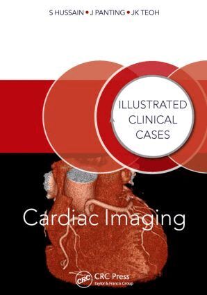 Shahid Hussain, Jonathan Panting, Jun Kiat Teoh - Cardiac Imaging, Häftad