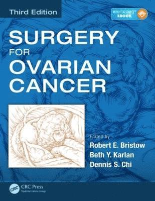 bokomslag Surgery for Ovarian Cancer