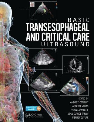 Basic Transesophageal and Critical Care Ultrasound 1
