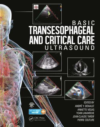 Basic Transesophageal and Critical Care Ultrasound 1