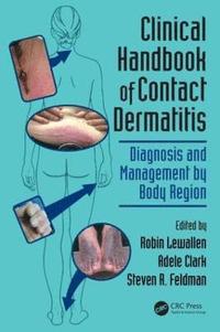 bokomslag Clinical Handbook of Contact Dermatitis