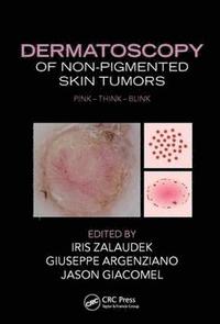bokomslag Dermatoscopy of Non-Pigmented Skin Tumors