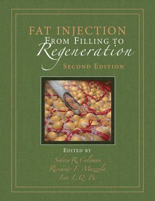 Fat Injection: From Filling to Regeneration, Second Edition