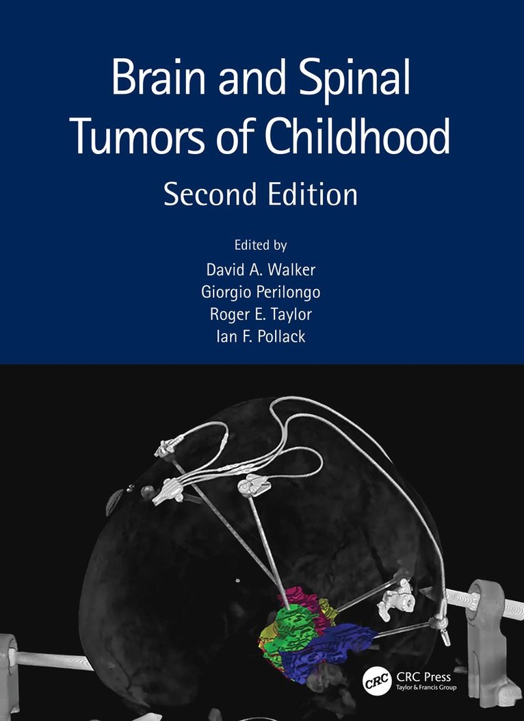 David A. Walker, Giorgio Perilongo, Roger E. Taylor, Ian F. Pollack, UK) Walker, David A. (Queens Medical Centre, Nottingham, Italy) Perilongo, Giorgio (University of Padua, UK) Taylor, Roger E. (Swansea University, Wales, USA) Pollack, Ian F. (Children's Hospital of Pittsburgh - Brain and Spinal Tumors of Childhood, Inbunden