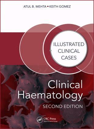 Atul Bhanu Mehta, Keith Gomez - Clinical Haematology, Häftad
