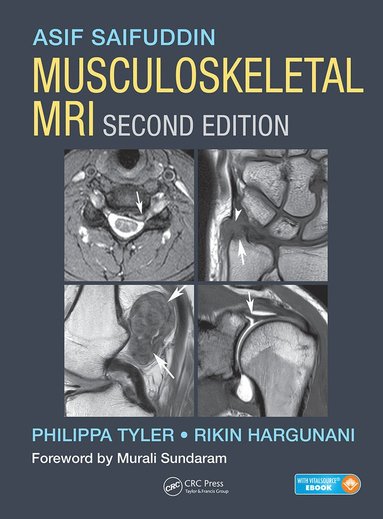 bokomslag Musculoskeletal MRI