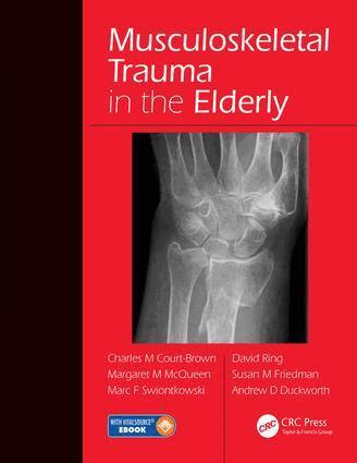 Charles Court-Brown, Margaret McQueen, Marc F. Swiontkowski, David Ring, Susan M. Friedman, Andrew David Duckworth - Musculoskeletal Trauma in the Elderly, Inbunden