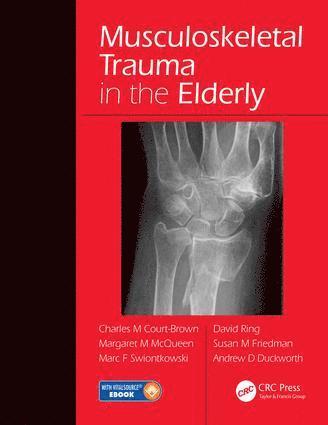 Charles Court-Brown, Margaret McQueen, Marc F. Swiontkowski, David Ring, Susan M. Friedman, Andrew David Duckworth, M.D. Swiontkowski, Marc F. - Musculoskeletal Trauma in the Elderly, Inbunden