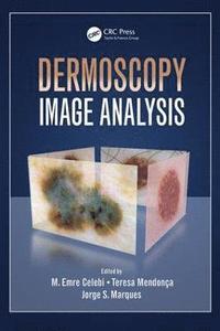 bokomslag Dermoscopy Image Analysis