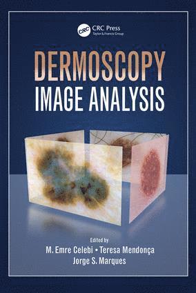 Dermoscopy Image Analysis 1