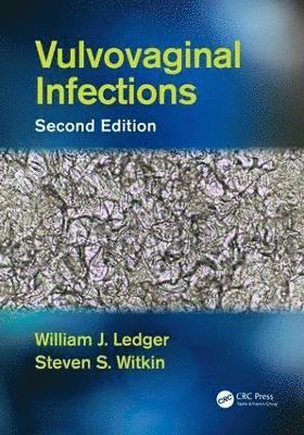 Vulvovaginal Infections 1