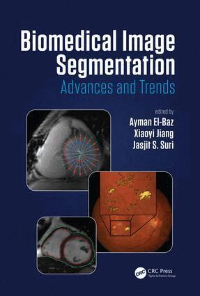 Ayman El-Baz, Xiaoyi Jiang, Jasjit S. Suri - Biomedical Image Segmentation, Inbunden