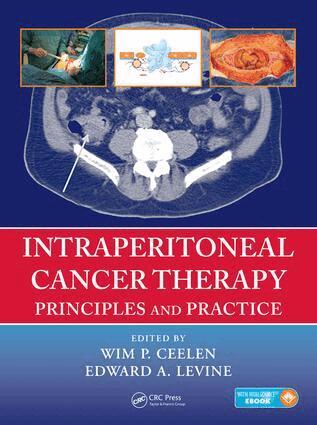 Wim P. Ceelen, Edward Levine - Intraperitoneal Cancer Therapy, Inbunden