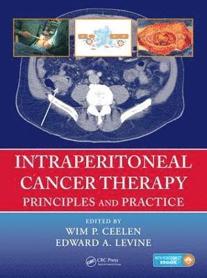 Intraperitoneal Cancer Therapy 1