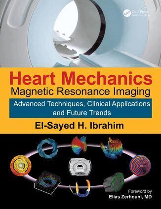 El-Sayed H. Ibrahim - Heart Mechanics, Inbunden