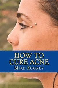 bokomslag How To Cure Acne: What Is Acne And The Best Treatments For Acne