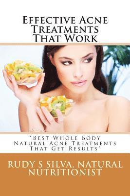 Rudy Silva Silva - Effective Acne Treatments That Work: "Best Whole Body Natural Acne Treatments That Get Results", Häftad