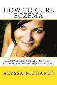 bokomslag How To Cure Eczema: Natural Eczema Treatment To Get Rid Of Skin Problems Once And For All