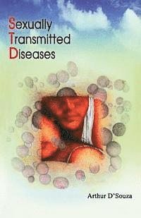 Arthur H. D'Souza - Sexually Transmitted Diseases, Häftad