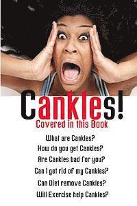 Cankles: This Guide will answer all of your Cankles questions 1