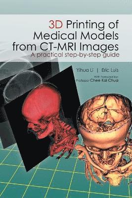 3D Printing of Medical Models from CT-MRI Images 1