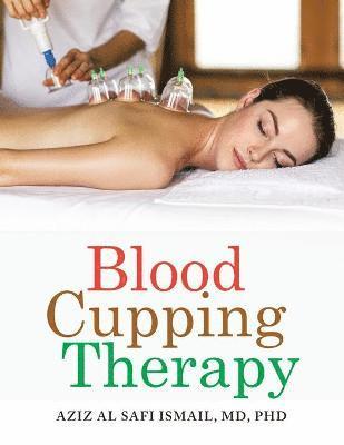 Blood Cupping Therapy 1
