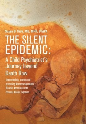 Mph Rich, Susan D. Rich, MD, MPH - Silent Epidemic, Inbunden