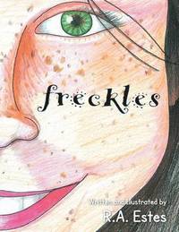 bokomslag Freckles