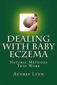 bokomslag Dealing With Baby Eczema: Natural Methods That Work